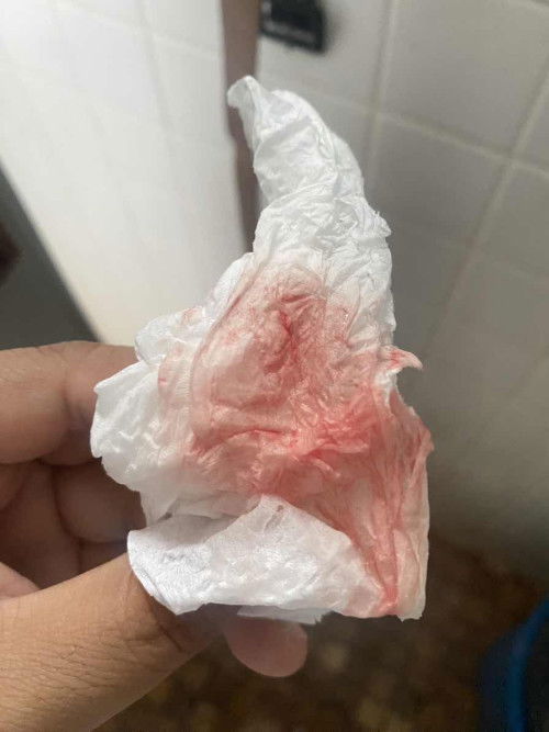 สอบถามแม่ๆท้อง 7w มีเลือดไหลแบบนี้ แต่ว่าไม่ปวดท้องเลยอันตรายไหมคะ