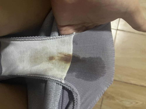 เลือดสีน้ำตาล ท้อง 7 สัปดาห์