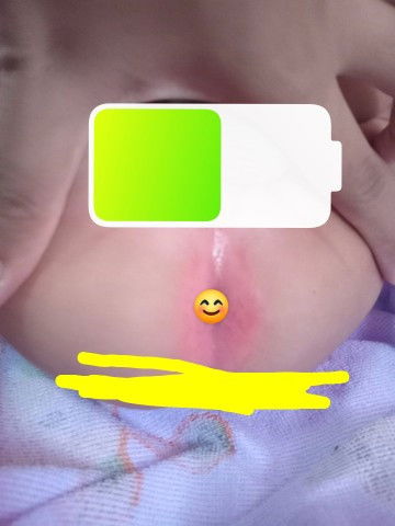 รอบๆรูทวารน้องแดงแบบนี้เกิดจากอะไรคะ ใช้อะไรทาได้บ้าง