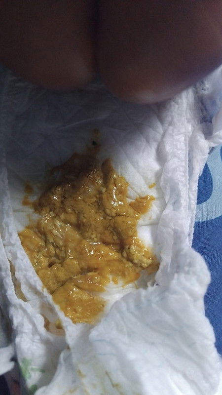 Anak saya kemarin bab kaya sambal pecell agak kental tapi encer gitu,trs sudah ak priksa dibidan tr