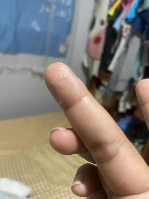 แม่สงสัยว่าใช่มูกไหม