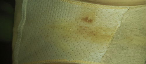 Hello po ano po kaya ito? 38weeks &3days medyo malapot po sya