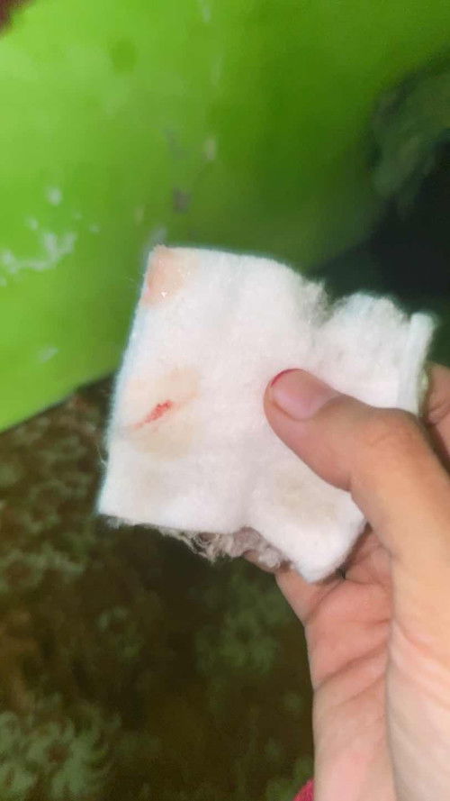 Usia kandungan 41 week