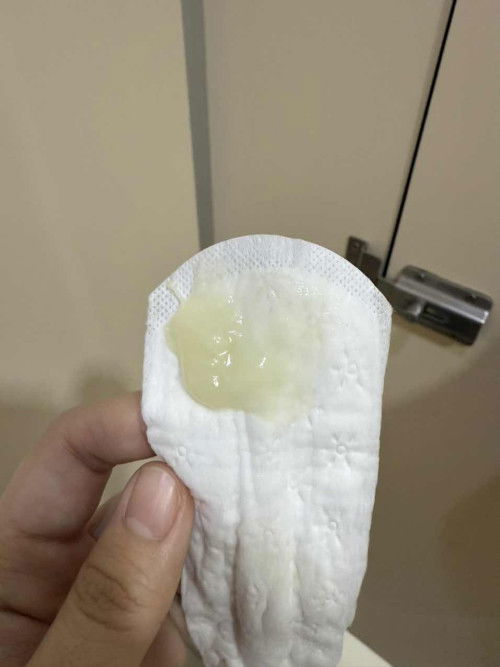 5 months pregnant Discharge