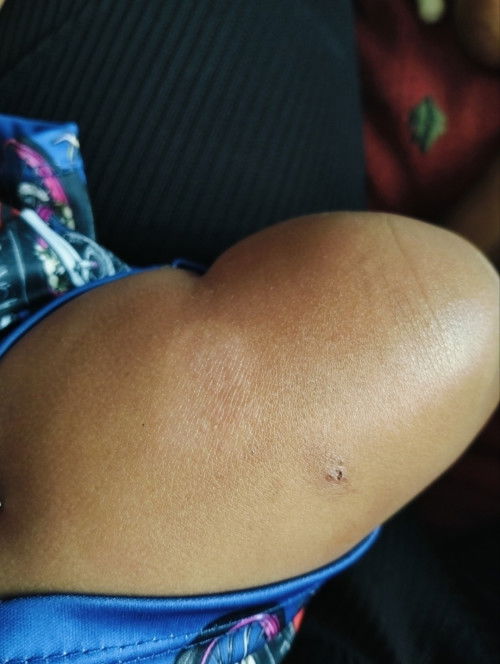 น้องเป็นแบบนี้คือเป็นเพราะอะไรคะ