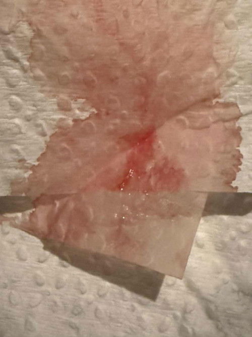 KANDUNGAN TAK MENJADI