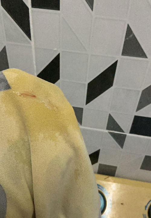 ท้อง37+4อาการแบบนี้ควรไปหาหมอมั้ย