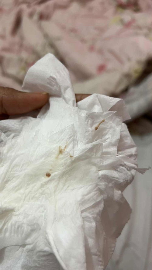 Flek kecoklatan, apakah normal?