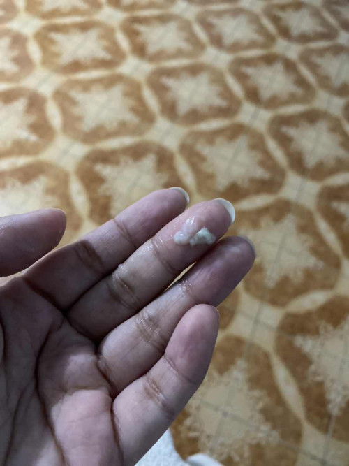 แบบนี้เรียกมูกหรือป่าวค่ะออกมาแค่นี้