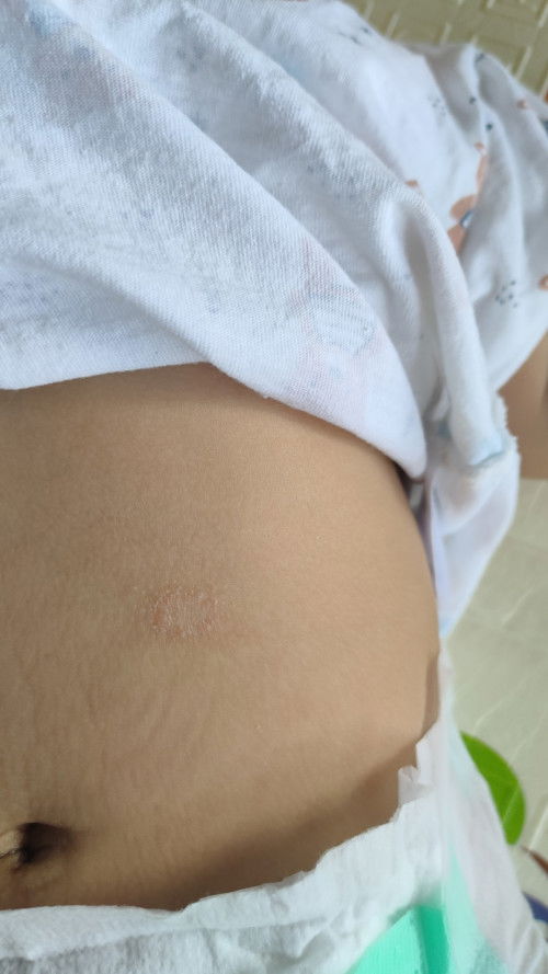 มียาแนะนำไหมคะ(เด็ก4เดือน)