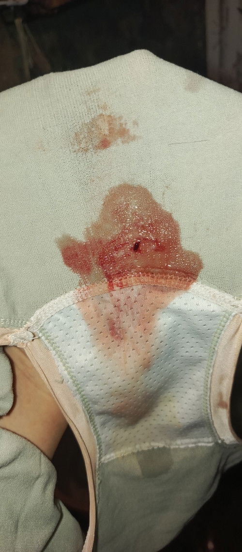 38weeks & 4days may same po ba sakin na ganito bigla nalang po lumabas sakin any advice po