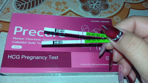 การตั้งครรภ์