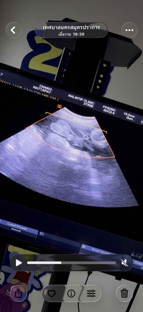 การตั้งงครรภ์