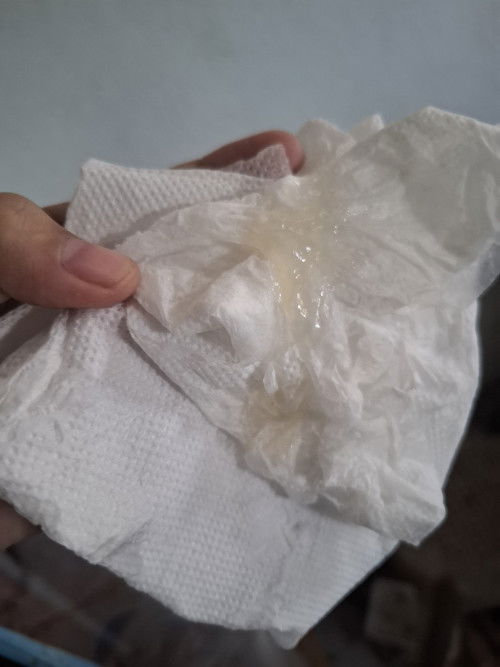 มูกใสมาแบบนี้. วันนี้มาเยอะมาก ตอนนี้แม่ตั้งท้องดั้ย38+1w. แต่ไม่มีอาการเจ็บท้องดัยๆนะค่ะ