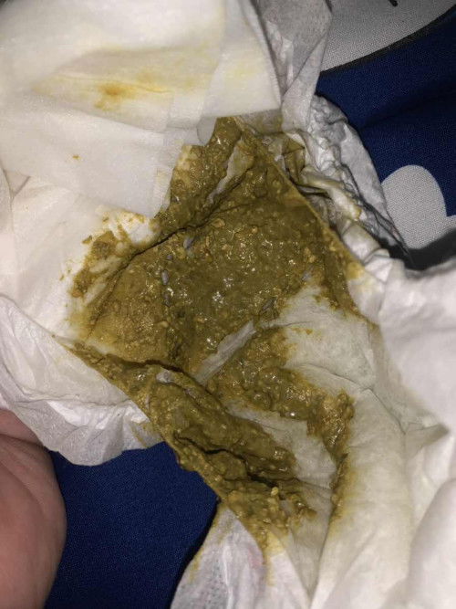 แบบนี้ปกติไหมคะ