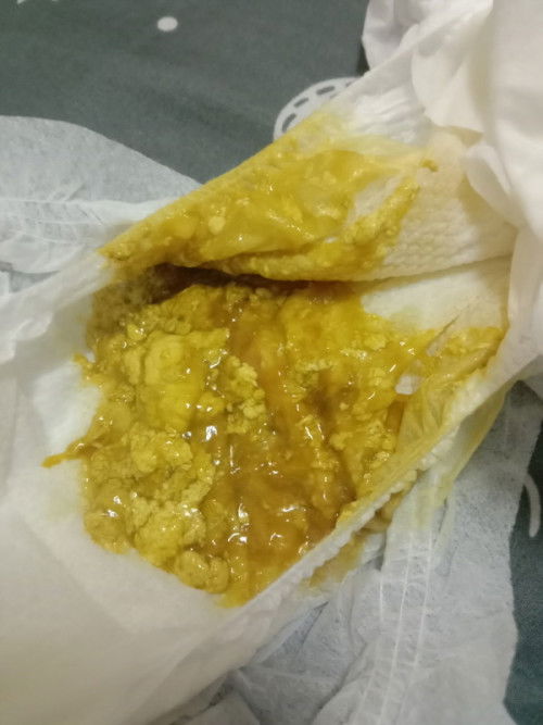 อึลูกแบบปกติมั้ยค่ะแม่