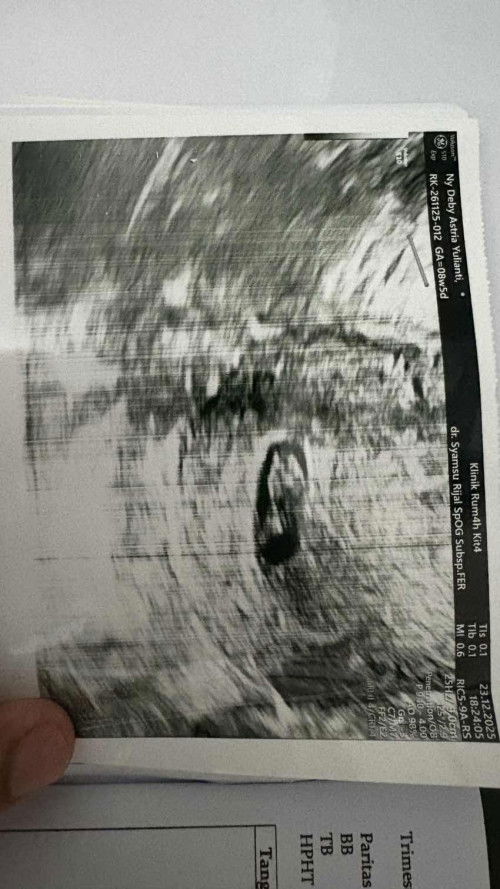 Beda sehari usg transvaginal detak jantung bayi gaada