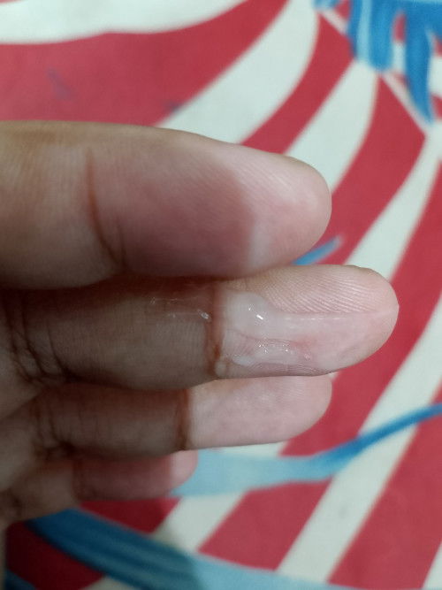 Bun mau tanya apakah ini lendir tanda2 mau melahirkan? Tadi jg pas udh Hb ada flek darah gtu Bun