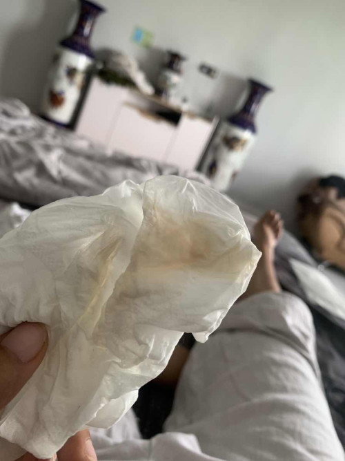 cairan keputihan jumlah banyak seperti kencing