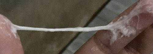 มีมูกใสออกมา