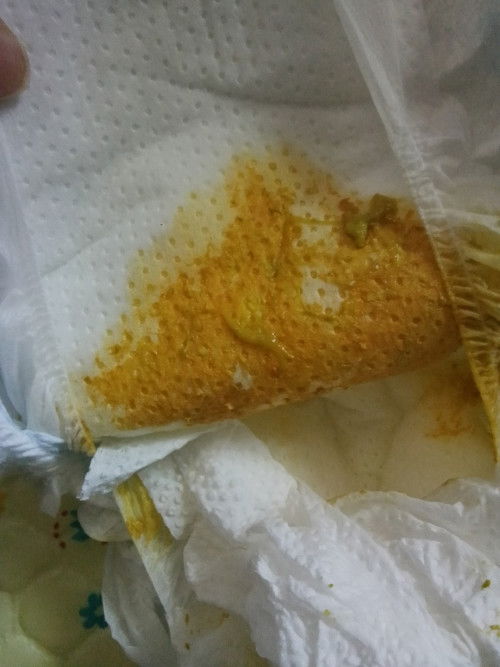 ลูกอึแบบนี้ปกติไหมคะแม่