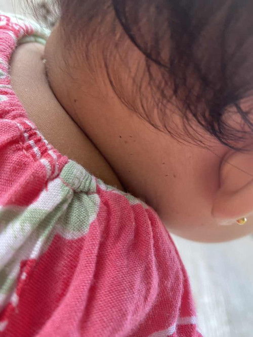 Bintik hitam kecil kecil