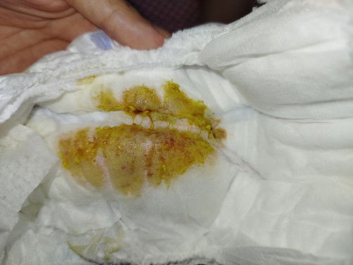 Maap ya jorok
Bun ada yg pernah ngalamin ee dedenya bedarah gini ga knp ya, tapi dia aktif biasa