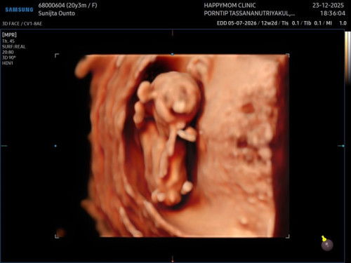 น้องได้12wแล้วค่ะอยากถามแม่ๆ
