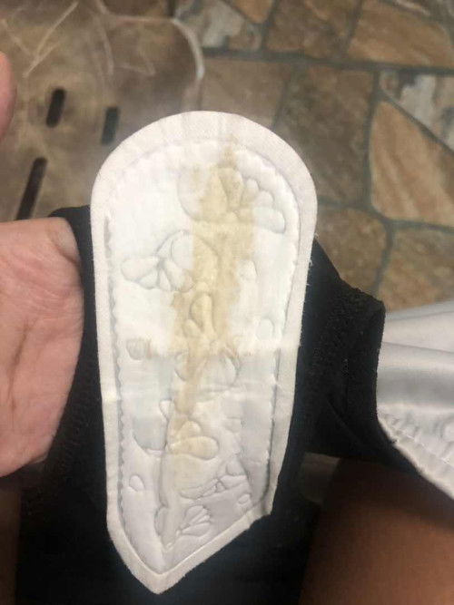 ขอสอบถามหน่อยค่ะแบบนี้ปกติไหม