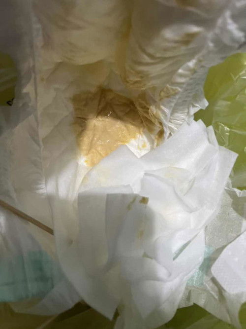 น้องท้องเสียไหมคะ