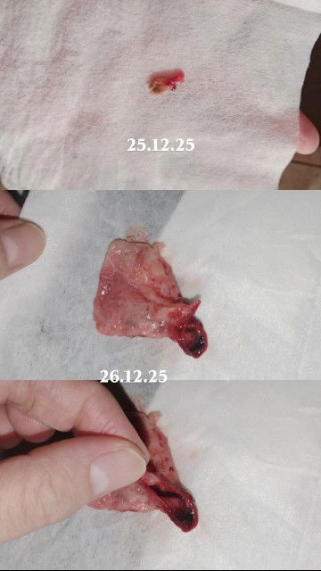 Ada yg berpengalaman tentang yg ni tak