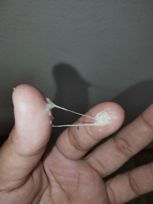 ท้อง35+1 มีมูกใสๆ4วัน วันนี้มูกแบบนี้ออกมา คือใกล้รึยังคะ ท้องแรกคลอดตอน34วีค