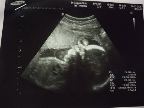 สอบถามแม่ๆหน่อยคะ สงสัยว่าจะเป็นอะไรคะ