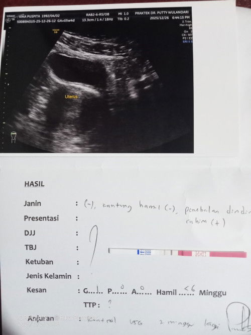 penebalan dinding rahim