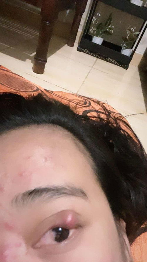 MATA SEPERTI BINTILAN