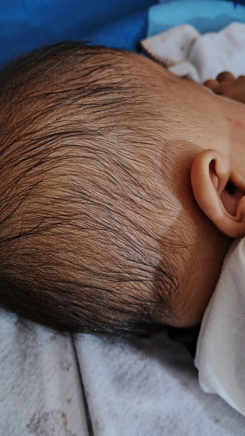 Kringetan berlebihan