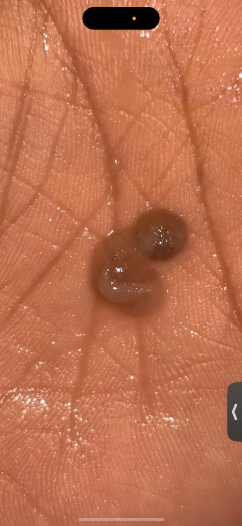 Keluar flek coklat pada usia 8 week