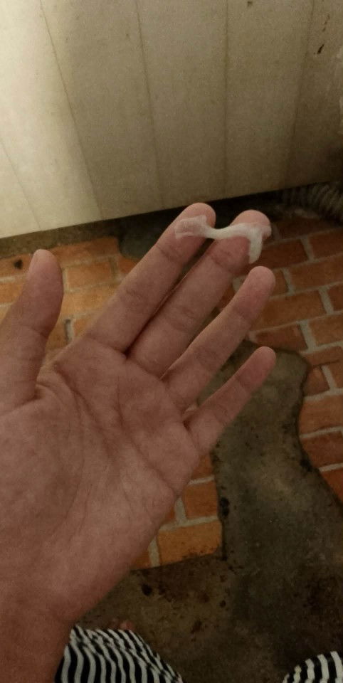 ตอบหนูทีค่ะท้องแรก