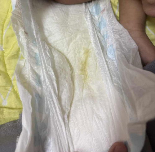 Normal ke kencing baby 1bulan18hari mcm ni