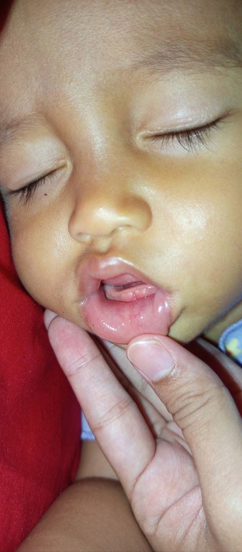 Tumbuh gigi susah makan