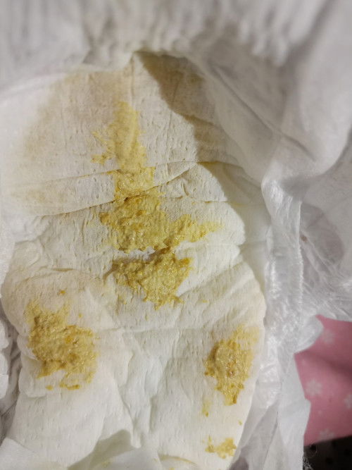 Yellow poop. pasintabi po mga mommy.