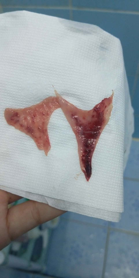 ประจำเดือนขาด2เดือนพึ่งมาเดือนนี้