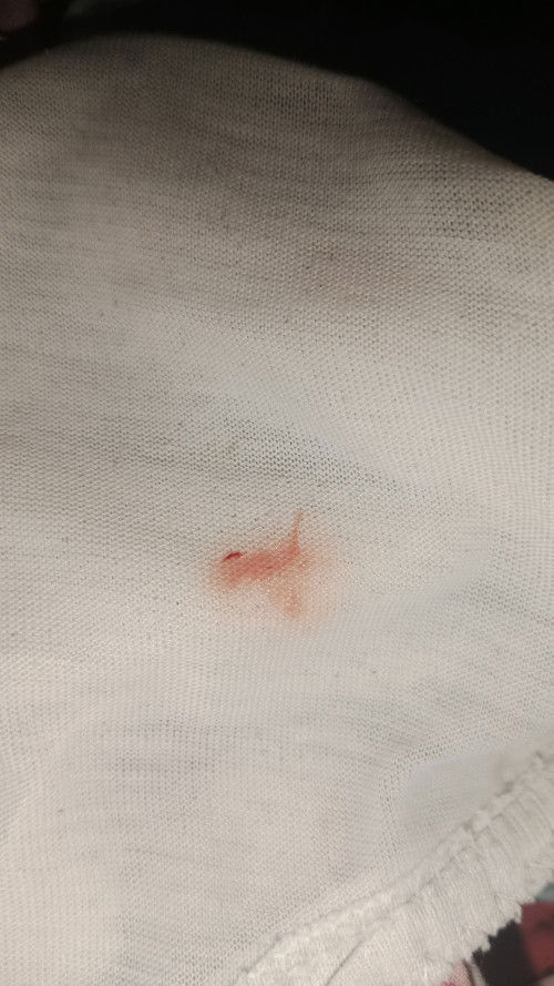 Keluar flek merah muda diusia kandungan 11 minggu