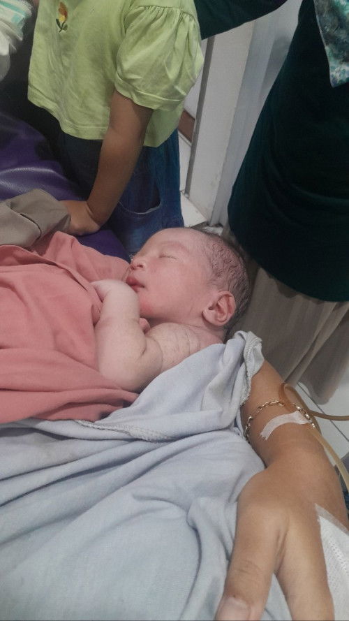 VBAC (Melahirkan pervaginam setelah sesar)