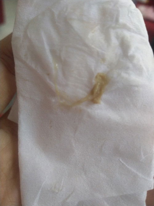 Keputihan lengket kuning kecoklatan, hamil 8 minggu