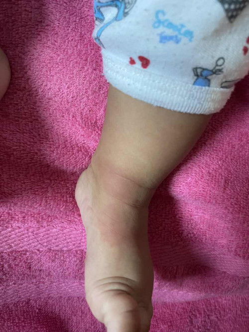 เเบบนี้โดนอะไรค่ะเเม่ๆ