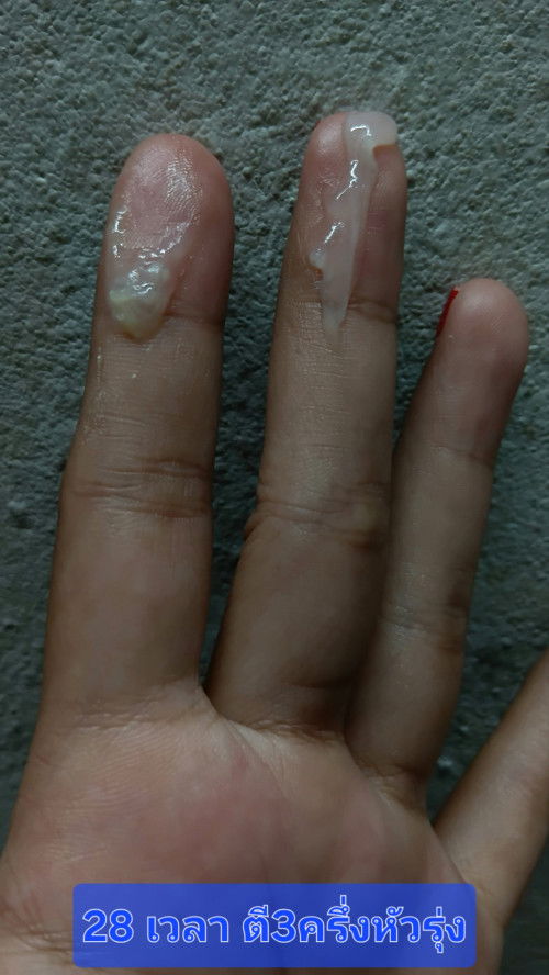 ท้อง32สัปดาห์1วัน เป็นมูกเลือดหรือกขาวค่ะดูให้หน่อย สีเหลืองใสข้นเหมือนเหนียว