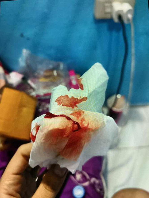 ท้อง6เดือนเลือดออก