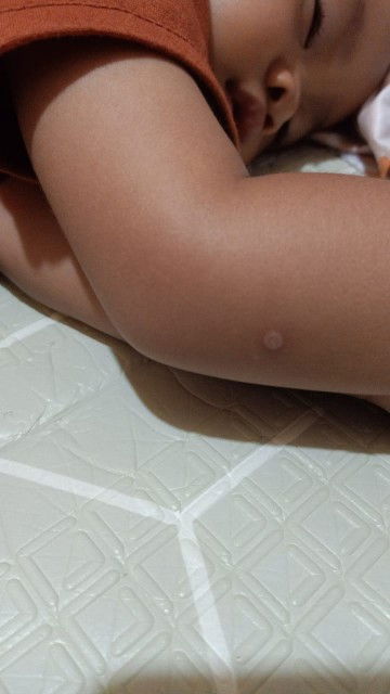 Halo bunda2, apakah ada anak nya yg tangan nya seperti ini, ini kira2 kenapa ya bund?