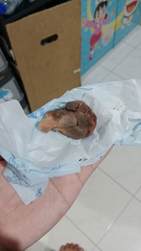 Keluar gumpalan kasa  divagina